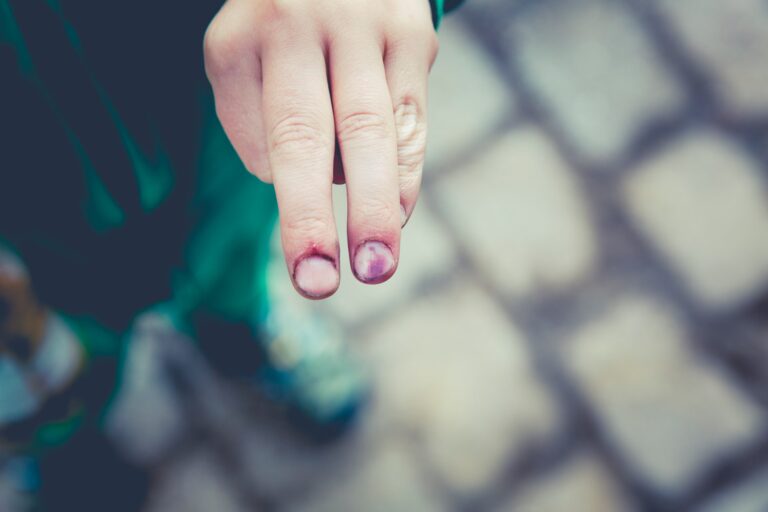 Injuries – When to Treat at Home and When to Go to the Hospital?
