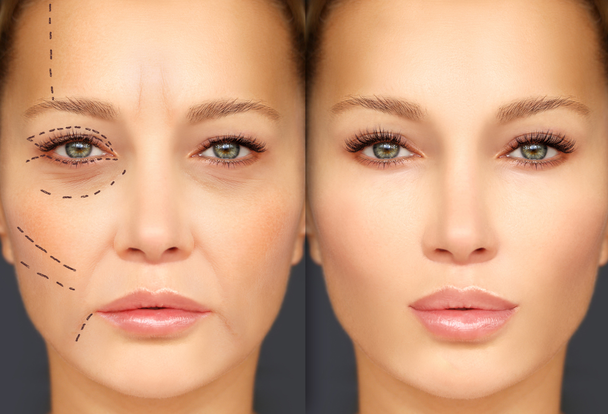 What Are The Most Requested Cosmetic Plastic Surgery Procedures 