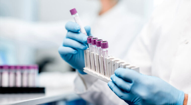 10 Reasons You Need Hormone Testing In 2024