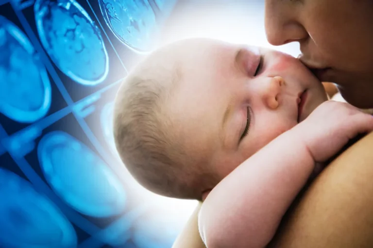 Brain Damage at Birth ─ How Common is It?